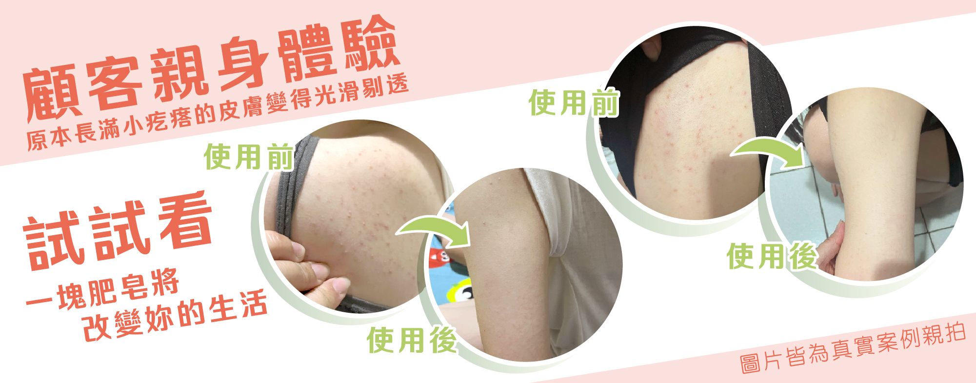 顧客親身體驗益生菌皂，使用一段時間後明顯改善膚質