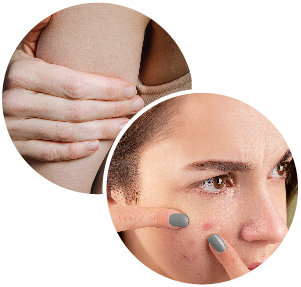 適用體質，特殊肌膚、長痘痘、過敏